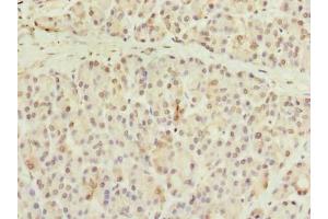 Immunohistochemistry of paraffin-embedded human pancreatic tissue using ABIN7148076 at dilution of 1:100 (CCDC116 anticorps  (AA 1-300))