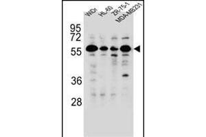 FOXC2 Antibody (Center ) (ABIN655526 and ABIN2845039) western blot analysis in WiDr,HL-60,ZR-75-1,MDA-M cell line lysates (35 μg/lane). (FOXC2 anticorps  (AA 183-210))