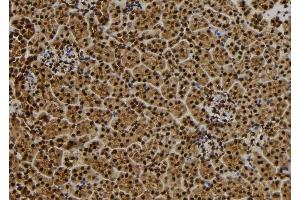 ABIN6279445 at 1/100 staining Mouse kidney tissue by IHC-P. (QSER1 anticorps  (Internal Region))