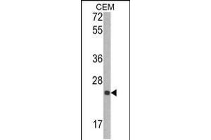 Western blot analysis of TIMP1 Antibody in CEM cell line lysates (35ug/lane) (TIMP1 anticorps  (N-Term))