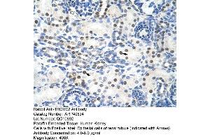Rabbit Anti-TROVE2 Antibody  Paraffin Embedded Tissue: Human Kidney Cellular Data: Epithelial cells of renal tubule Antibody Concentration: 4. (TROVE2 anticorps  (N-Term))