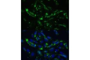 Immunofluorescence analysis of U2OS cells using CGRP antibody (ABIN6128310, ABIN6137852, ABIN6137855 and ABIN6221187) at dilution of 1:100.
