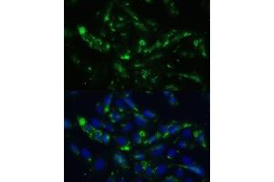 Immunofluorescence analysis of U2OS cells using CGRP antibody (ABIN6128310, ABIN6137852, ABIN6137855 and ABIN6221187) at dilution of 1:100. (CGRP anticorps  (AA 1-141))