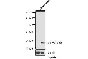 Western blot analysis of extracts from Mouse brain tissue using Phospho-SNCA(S129) Polyclonal Antibody. (SNCA anticorps  (pSer129))