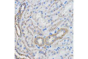 Immunohistochemistry of paraffin-embedded Rat kidney using CYP51 Rabbit pAb (3485) at dilution of 1:50 (40x lens).
