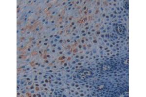 IHC-P analysis of esophagus tissue, with DAB staining. (TRERF1 anticorps  (AA 779-936))
