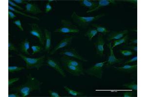 Immunofluorescence of purified MaxPab antibody to NUFIP1 on HeLa cell. (NUFIP1 anticorps  (AA 1-276))