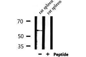 Western blot analysis of extracts from rat brain,mouse brain,rat spleen, using THBD Antibody.