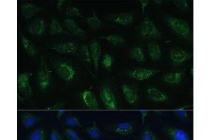 Immunofluorescence analysis of U-2 OS cells using RAPGEF1 Polyclonal Antibody at dilution of 1:100 (40x lens). (GRF2 anticorps)