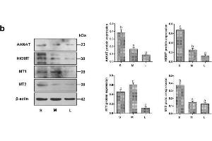 Relative expression of AANAT, HIOMT, MT1, and MT2 in COCs of follicles of different sizes.