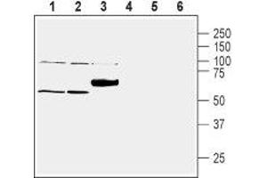Western blot analysis of mouse lung lysate (lanes 1 and 4), rat liver lysate (lanes 2 and 5) and rat brain membranes (lanes 3 and 6): - 1-3. (SLC30A1 anticorps  (C-Term, Intracellular))