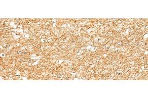 Immunohistochemistry of paraffin-embedded Human brain tissue using ZNF185 Polyclonal Antibody at dilution of 1:25(x200)