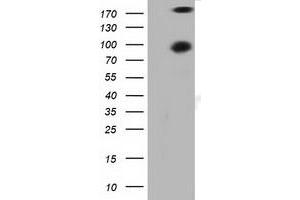 Western Blotting (WB) image for anti-Protein Kinase D2 (PKD2) antibody (ABIN1500413) (PKD2 anticorps)