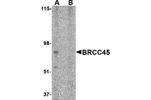Western Blotting (WB) image for anti-Brain and Reproductive Organ-Expressed (TNFRSF1A Modulator) (BRE) (N-Term) antibody (ABIN1031282) (BRE anticorps  (N-Term))