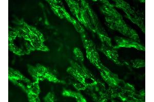 Image no. 1 for anti-Cardiotin antibody (ABIN335362) (Cardiotin anticorps)