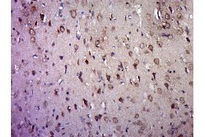 Paraformaldehyde-fixed, paraffin embedded rat brain, Antigen retrieval by boiling in sodium citrate buffer (pH6. (HTR2A anticorps  (AA 65-160))