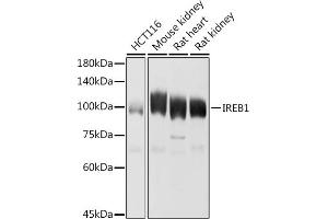 Western blot analysis of extracts of various cell lines, using IREB1 antibody (ABIN6128144, ABIN6136437, ABIN6136439 and ABIN6223846) at 1:1000 dilution. (Aconitase 1 anticorps  (AA 1-170))