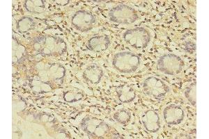 Immunohistochemistry of paraffin-embedded human small intestine tissue using ABIN7174767 at dilution of 1:100 (C19orf47 anticorps  (AA 1-281))