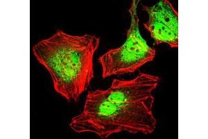 Immunofluorescence analysis of HeLa cells using CK5 mouse mAb (green).