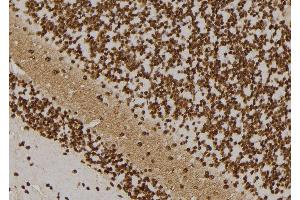 ABIN6273533 at 1/100 staining Rat brain tissue by IHC-P.