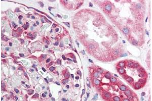 Human Kidney (formalin-fixed, paraffin-embedded) stained with TNFRSF10A antibody ABIN214531 at 5 ug/ml followed by biotinylated goat anti-rabbit IgG secondary antibody ABIN481713, alkaline phosphatase-streptavidin and chromogen. (TNFRSF10A anticorps)