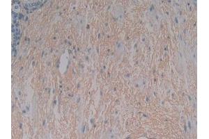 DAB staining on IHC-P; Samples: Human Stomach Tissue