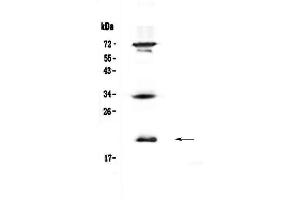 Western blot analysis of IL17B  using anti-IL17B  antibody .