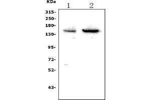 Western blot analysis of SENP6 using anti-SENP6 antibody (ABIN7599979).