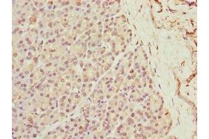 Immunohistochemistry of paraffin-embedded human pancreatic tissue using ABIN7175917 at dilution of 1:100 (xpr1 anticorps  (AA 529-696))