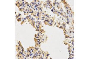 Immunohistochemistry (IHC) image for anti-Microtubule-Associated Protein 1 Light Chain 3 alpha (MAP1LC3A) antibody (ABIN1876819) (MAP1LC3A anticorps)