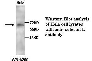 Image no. 1 for anti-Selectin E (SELE) antibody (ABIN790883) (Selectin E/CD62e anticorps)
