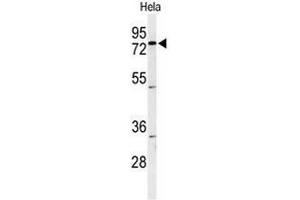 Western blot analysis of CLPTM1 Antibody (Center) in Hela cell line lysates (35µg/lane). (CLPTM1 anticorps  (Middle Region))