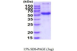 Frizzled Family Receptor 4 (FZD4) (AA 37-222) protein (hIgG-His-tag)