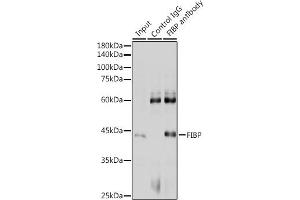 Immunoprecipitation analysis of 300 μg extracts of HeLa cells using 3 μg FIBP antibody .