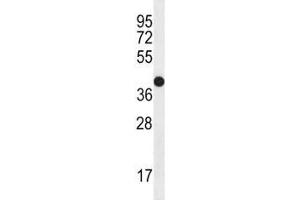CD271 antibody western blot analysis in MDA-MB435 lysate. (NGFR anticorps  (AA 353-380))