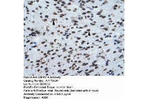 Rabbit Anti-Q9HB14 Antibody  Paraffin Embedded Tissue: Human Brain Cellular Data: Neural Cells Antibody Concentration: 4. (KCNK13 anticorps  (C-Term))