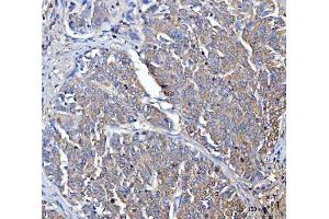 IHC analysis of Dicer/DICER1 using anti-Dicer/DICER1 antibody (ABIN3043347).