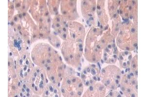 Detection of NOSTRIN in Rat Kidney Tissue using Polyclonal Antibody to Nitric Oxide Synthase Trafficker (NOSTRIN)