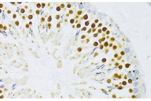 Immunohistochemistry of paraffin-embedded Rat testis using TFDP1 Polyclonal Antibody at dilution of 1:100 (40x lens). (DP1 anticorps)