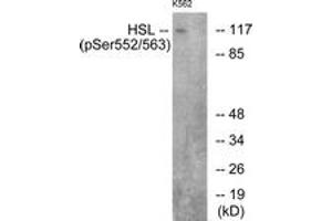 Western blot analysis of extracts from K562 cells, using HSL (Phospho-Ser552) Antibody. (LIPE anticorps  (pSer552))