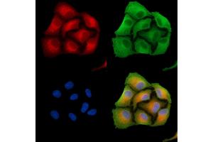ABIN6260377 and ABIN6279248 staining  cells by IF/ICC.