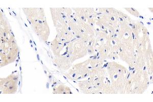 Detection of MYH7 in Human Cardiac Muscle Tissue using Monoclonal Antibody to Myosin Heavy Chain 7, Cardiac Muscle, Beta (MYH7)