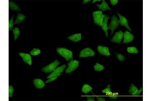 Immunofluorescence of monoclonal antibody to TRAF3IP2 on HeLa cell.