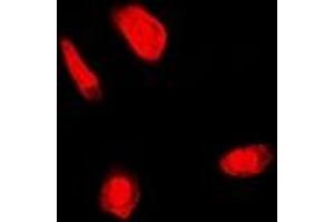 Immunofluorescent analysis of FANCC staining in U2OS cells. (FANCC anticorps)