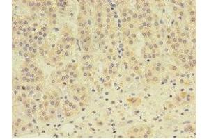 Immunohistochemistry of paraffin-embedded human adrenal gland tissue using ABIN7145562 at dilution of 1:100 (EPHX2 anticorps  (AA 1-555))