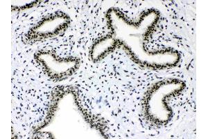 IHC analysis of Musashi 1/Msi1 using anti- Musashi 1/Msi1 antibody .