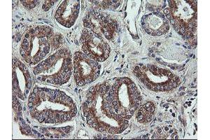 Image no. 7 for anti-Prefoldin Subunit 3 (PFDN3) antibody (ABIN1501704)