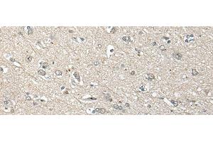 Immunohistochemistry of paraffin-embedded Human brain tissue using UCN3 Polyclonal Antibody at dilution of 1:55(x200)