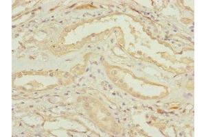 Immunohistochemistry of paraffin-embedded human kidney tissue using ABIN7147433 at dilution of 1:100 (CCDC41 anticorps  (AA 34-260))