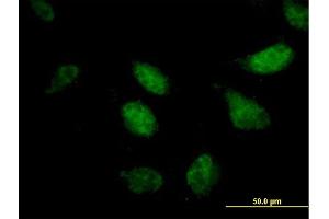 Immunofluorescence of purified MaxPab antibody to ZNF342 on HeLa cell. (Zinc Finger Protein 296 (ZNF296) (AA 1-475) anticorps)